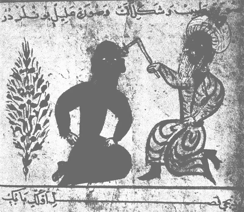 Bilde av en arabisk helbreder som gir akupunktur i året 1450.