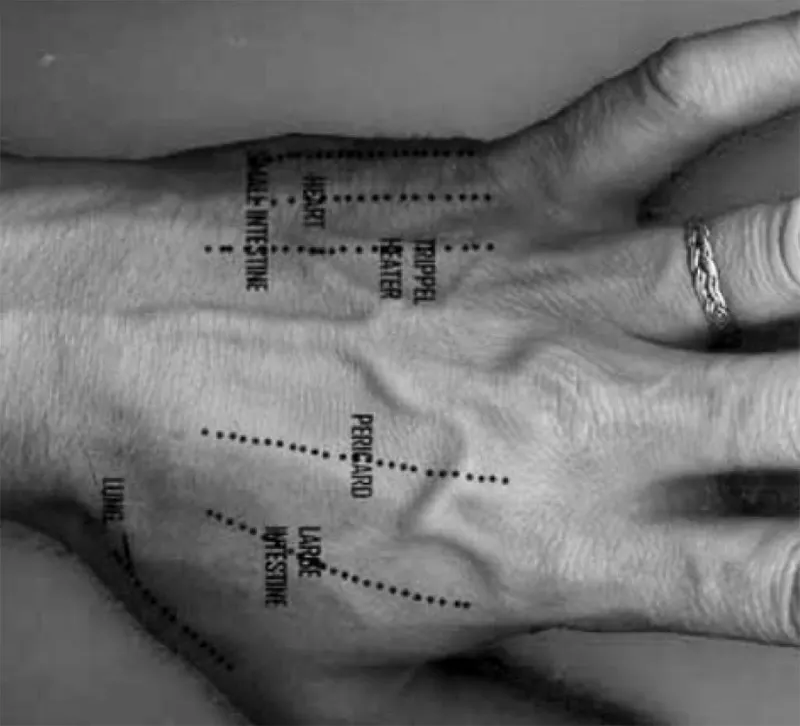 Hand mit akupuncture Punkte